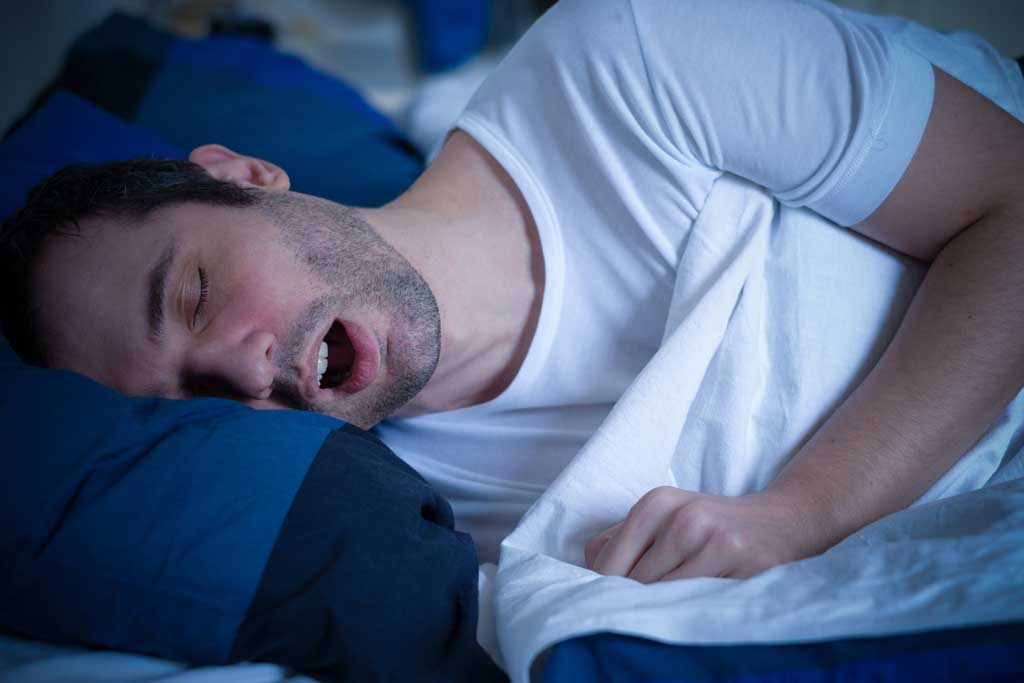 Male-snoring-in-bed-with-his-mouth-open-and-needing-LATERA-implant