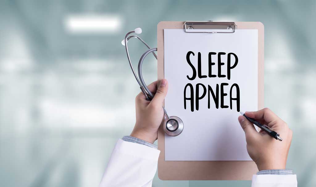 Physician-holding-a-clipboard-with-_sleep-apnea_-written