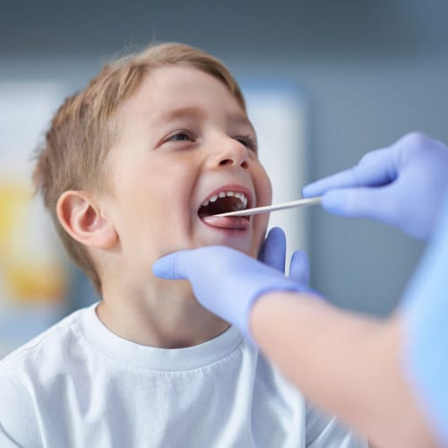 Beverly-Hills-Tonsil-Surgery