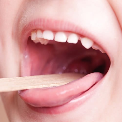 Tonsils-Removal-Beverly-Hills